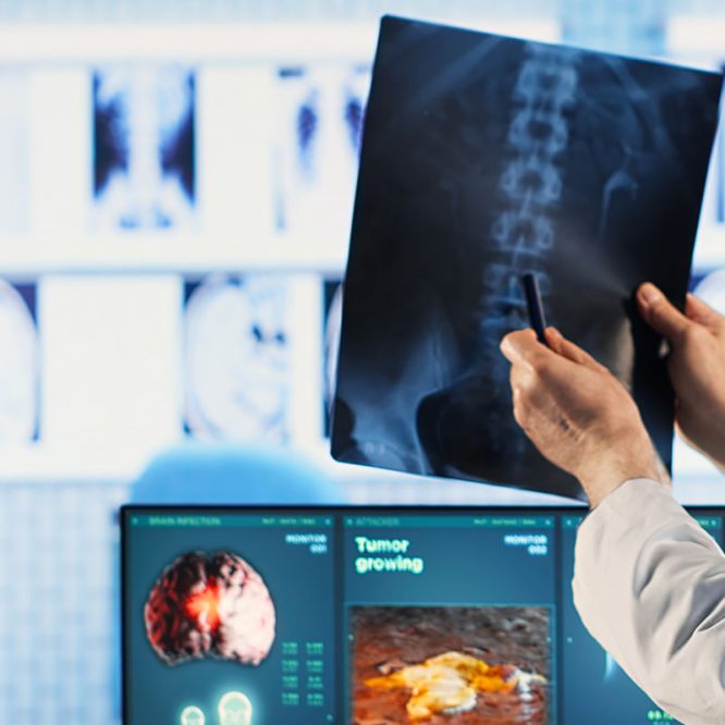 Endoskopik Omurga, Endoskopik Omurga Cerrahisi, Endoskopik omurga ameliyatı, Endoskopik bel fıtığı ameliyatı, Endoskopik boyun fıtığı ameliyatı, Endoskopik kanal daralması ameliyatı, Minimal invaziv omurga cerrahisi, Omurga cerrahisi yöntemleri, Omurga ameliyatı endoskopik teknik, Bel fıtığı endoskopik tedavi, Boyun fıtığı endoskopik tedavi, Spinal endoskopik cerrahi, Endoskopik omurga cerrahisi uzmanı, Endoskopik omurga cerrahisi doktoru, En İyi Endoskopik omurga cerrahisi uzmanı, En İyi Endoskopik omurga cerrahisi doktoru, En İyi Endoskopik cerrahi Doktoru, En İyi Endoskopik cerrahi Uzmanı