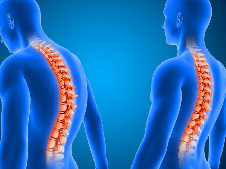 Endoskopik Omurga, Endoskopik Omurga Cerrahisi, Endoskopik omurga ameliyatı, Endoskopik bel fıtığı ameliyatı, Endoskopik boyun fıtığı ameliyatı, Endoskopik kanal daralması ameliyatı, Minimal invaziv omurga cerrahisi, Omurga cerrahisi yöntemleri, Omurga ameliyatı endoskopik teknik, Bel fıtığı endoskopik tedavi, Boyun fıtığı endoskopik tedavi, Spinal endoskopik cerrahi, Endoskopik omurga cerrahisi uzmanı, Endoskopik omurga cerrahisi doktoru, En İyi Endoskopik omurga cerrahisi uzmanı, En İyi Endoskopik omurga cerrahisi doktoru, En İyi Endoskopik cerrahi Doktoru, En İyi Endoskopik cerrahi Uzmanı