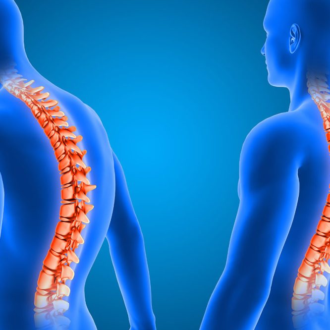 Endoskopik Omurga, Endoskopik Omurga Cerrahisi, Endoskopik omurga ameliyatı, Endoskopik bel fıtığı ameliyatı, Endoskopik boyun fıtığı ameliyatı, Endoskopik kanal daralması ameliyatı, Minimal invaziv omurga cerrahisi, Omurga cerrahisi yöntemleri, Omurga ameliyatı endoskopik teknik, Bel fıtığı endoskopik tedavi, Boyun fıtığı endoskopik tedavi, Spinal endoskopik cerrahi, Endoskopik omurga cerrahisi uzmanı, Endoskopik omurga cerrahisi doktoru, En İyi Endoskopik omurga cerrahisi uzmanı, En İyi Endoskopik omurga cerrahisi doktoru, En İyi Endoskopik cerrahi Doktoru, En İyi Endoskopik cerrahi Uzmanı